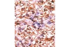 Image no. 2 for anti-Retinoblastoma 1 (RB1) (pSer788) antibody (ABIN358214) (Retinoblastoma 1 anticorps  (pSer788))