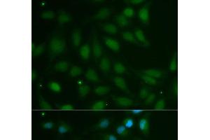 Immunofluorescence analysis of MCF-7 cells using ABO Polyclonal Antibody (ABO anticorps)