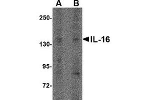 Western Blotting (WB) image for anti-Interleukin 16 (IL16) (N-Term) antibody (ABIN1031408)