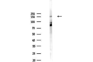 Western blot analysis of lysates from PC12 cells(UV,30 min treatment), using Phospho-MCSF Receptor (Tyr809) Antibody at 1/1000 dilution.