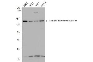 WB Image Various whole cell extracts (30 μg) were separated by 7. (SAFB anticorps)