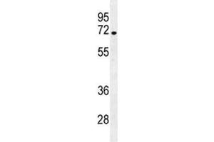 NUMB antibody western blot analysis in NCI-H292 lysate. (NUMB anticorps  (AA 1-30))