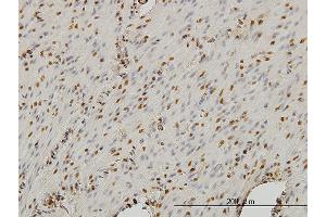 Immunoperoxidase of monoclonal antibody to STAG1 on formalin-fixed paraffin-embedded human smooth muscle.