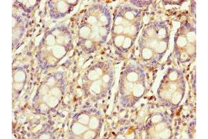 Immunohistochemistry of paraffin-embedded human colon tissue using ABIN7158817 at dilution of 1:100 (LYG1 anticorps  (AA 20-194))