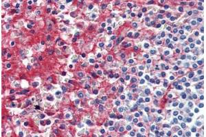 Anti-Collagen IV antibody IHC staining of human spleen.