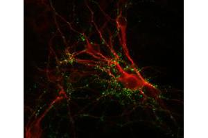 Immunochemical staining of cultured caudate neurons with SYN1 polyclonal antibody  (green) and anti-MAP antibody (red). (SYN1 anticorps)