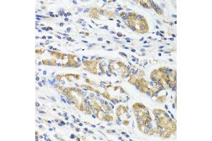 Immunohistochemistry of paraffin-embedded human stomach using IL11 antibody at dilution of 1:100 (40x lens). (IL-11 anticorps)