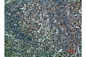 Immunohistochemical analysis of paraffin-embedded human-tonsils, antibody was diluted at 1:200