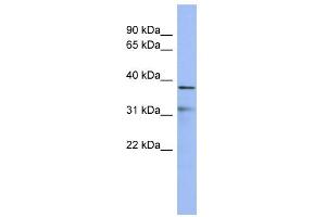 WB Suggested Anti-HEY2 Antibody Titration:  0. (HEY2 anticorps  (Middle Region))