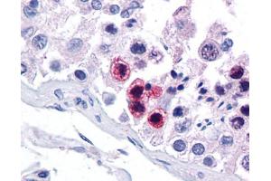 Immunohistochemistry (IHC) image for anti-RAR-Related Orphan Receptor C (RORC) (N-Term) antibody (ABIN2782284)