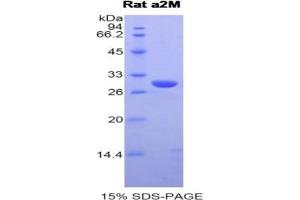 SDS-PAGE of Protein Standard from the Kit (Highly purified E.
