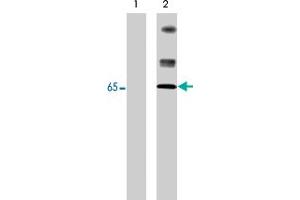 Western blot analysis of control (lane 1) and pervanadate-treated (lane 2) A-431 cells (20 ug/lane). (Neural Wiskott-Aldrich syndrome protein (WASL) (pTyr256) anticorps)