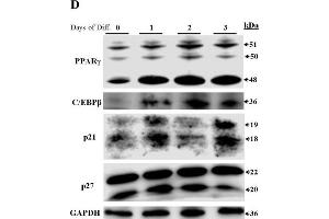 Expression of Dnmt3a spliced variants in adipose tissues and during the time-course analysis of preadipocyte differentiation. (CDKN1B anticorps  (AA 150-198))