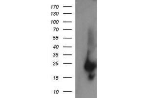 Image no. 1 for anti-RAB37, Member RAS Oncogene Family (RAB37) antibody (ABIN1500562) (RAB37 anticorps)