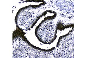 IHC analysis of STUB1 using anti-STUB1 antibody . (STUB1 anticorps  (AA 51-303))