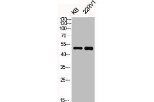 Western Blot analysis of KB 22RV1 cells using Phospho-KOR-1 (S369) Polyclonal Antibody