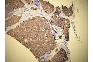 Immunohistochemistry (IHC) image for anti-Keratin 19 (KRT19) (AA 386-399), (C-Term) antibody (ABIN870579) (Cytokeratin 19 anticorps  (C-Term))
