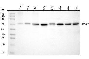 Western blot analysis of ADAM9 using anti-ADAM9 antibody (ABIN7601124).