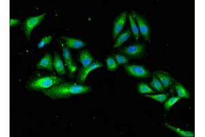 Immunofluorescent analysis of Hela cells using ABIN7158870 at dilution of 1:100 and Alexa Fluor 488-congugated AffiniPure Goat Anti-Rabbit IgG(H+L)