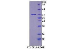 SDS-PAGE analysis of Human IHPK3 Protein. (IP6K3 Protéine)