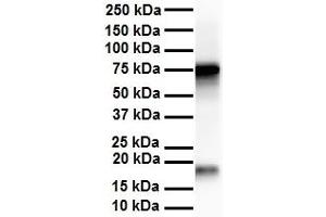WB Suggested Anti-APEH antibody Titration: 1 ug/mL Sample Type: Human liver