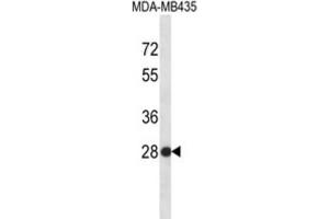 Western Blotting (WB) image for anti-Small Nuclear Ribonucleoprotein Polypeptide B (SNRPB2) antibody (ABIN2996703) (SNRPB2 anticorps)