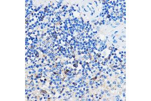 Immunohistochemistry of paraffin-embedded Human spleen using HC Rabbit pAb (ABIN7267805) at dilution of 1:100 (40x lens).
