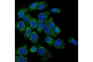 IF analysis of LPP using anti-LPP antibody (ABIN7599606).