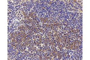 Immunohistochemistry analysis of paraffin-embedded mouse spleen using CD284 Polyclonal Antibody at dilution of 1:1000. (TLR4 anticorps)