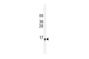 SG11A Antibody (N-term) (ABIN654791 and ABIN2844469) western blot analysis in NCI- cell line lysates (35 μg/lane). (SPAG11A anticorps  (N-Term))