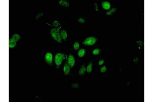 Immunofluorescent analysis of A549 cells using ABIN7163478 at dilution of 1:100 and Alexa Fluor 488-congugated AffiniPure Goat Anti-Rabbit IgG(H+L)
