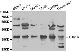 Western blot analysis of extracts of various cell lines, using TOR1A antibody. (TOR1A anticorps)