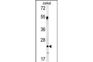 Western blot analysis of C1QA antibody in Jurkat cell line lysates (35ug/lane) (C1QA anticorps  (C-Term))