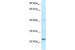 WB Suggested Anti-Rnf141 Antibody Titration: 1. (RNF141 anticorps  (N-Term))