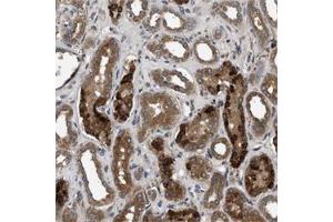 Immunohistochemical staining of human kidney shows strong positivity in tubuli.