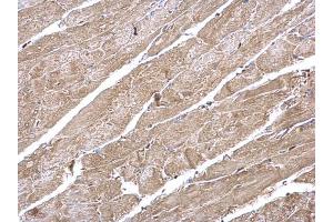 IHC-P Image CaMKII delta antibody detects CaMKII delta protein at cytoplasm on mouse heart by immunohistochemical analysis. (CAMK2D anticorps)