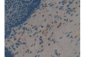 IHC-P analysis of Human Esophagus Tissue, with DAB staining. (Apolipoprotein F anticorps  (AA 122-307))