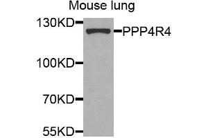 Western blot analysis of extracts of mouse lung, using PPP4R4 antibody (ABIN5974913) at 1/1000 dilution. (PPP4R4 anticorps)