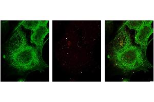 Immunohistochemistry.