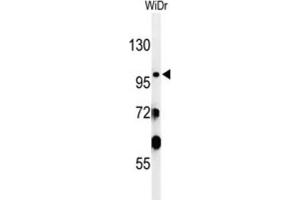 Western Blotting (WB) image for anti-Vacuolar Protein Sorting 52 Homolog (VPS52) antibody (ABIN3002120) (VPS52 anticorps)