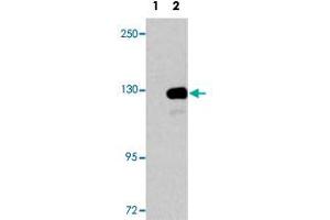 Western blot analysis of UPF1 (arrow) using UPF1 polyclonal antibody . (RENT1/UPF1 anticorps  (AA 7-37))