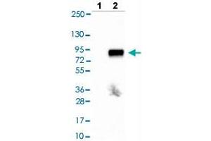 Western blot analysis of Lane 1: Negative control (vector only transfected HEK293T lysate), Lane 2: Over-expression lysate (Co-expressed with a C-terminal myc-DDK tag (~3. (Tyrosinase-Related Protein 1 anticorps  (AA 257-377))