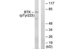 Western blot analysis of extracts from HeLa cells treated with Serum 10% 15', using BTK (Phospho-Tyr223) Antibody. (BTK anticorps  (pTyr223))