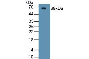 Detection of Recombinant CFTR, Human using Polyclonal Antibody to Cystic Fibrosis Transmembrane Conductance Regulator (CFTR)