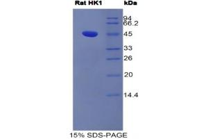 SDS-PAGE analysis of Rat Hexokinase 1 Protein. (Hexokinase 1 Protein (HK1))