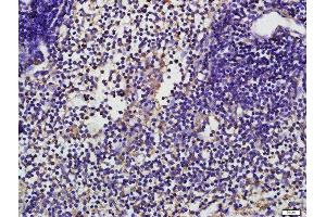 Paraformaldehyde-fixed, paraffin embedded mouse spleen tissue, Antigen retrieval by boiling in sodium citrate buffer(pH6) for 15min, Block endogenous peroxidase by 3% hydrogen peroxide for 30 minutes, Blocking buffer (normal goat serum) at 37°C for 20min, Antibody incubation with CD19 (Tyr531) Polyclonal Antibody, Unconjugated  at 1:500 overnight at 4°C, followed by a conjugated secondary and DAB staining