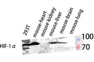 Western Blot (WB) analysis of 293T Mouse Brain Mouse Spleen Mouse Heart lysis using HIF-1alpha antibody. (HIF1A anticorps  (Internal Region))