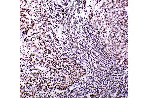 Anti-B MyB antibody, IHC(P) IHC(P): Human Tonsil Tissue (MYBL2 anticorps  (N-Term))