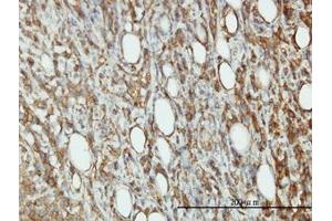 Image no. 3 for anti-Eukaryotic Translation Initiation Factor 5 (EIF5) (AA 1-432) antibody (ABIN598657) (EIF5 anticorps  (AA 1-432))