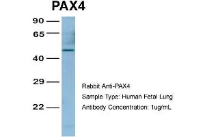 Host:  Rabbit  Target Name:  PAX4  Sample Type:  Human Fetal Lung  Antibody Dilution:  1. (PAX4 anticorps  (Middle Region))
